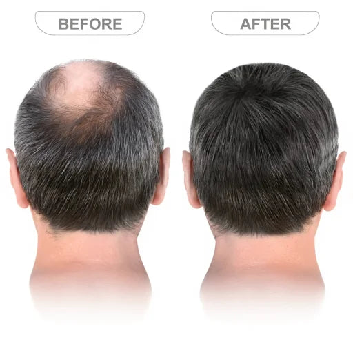 Hair Growth Serum Roll On