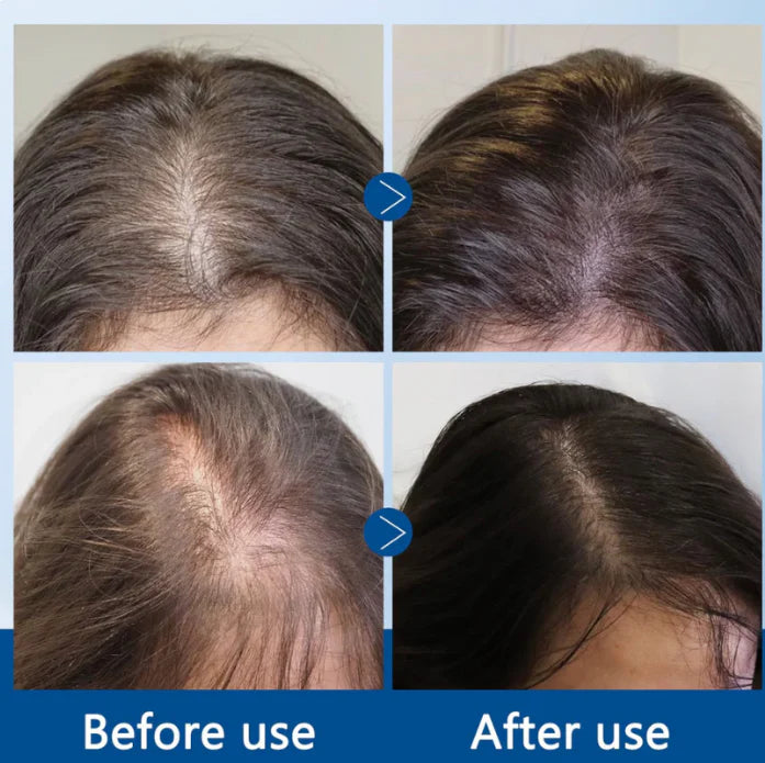 Hair Growth Serum Roll On