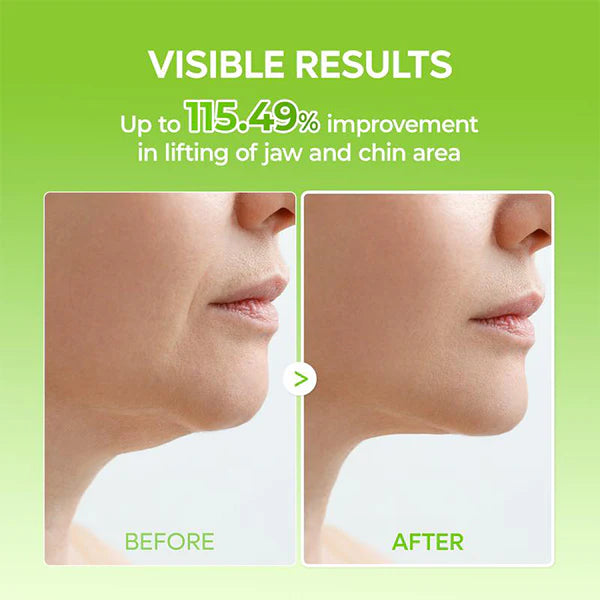 Chin V-Lift Mask